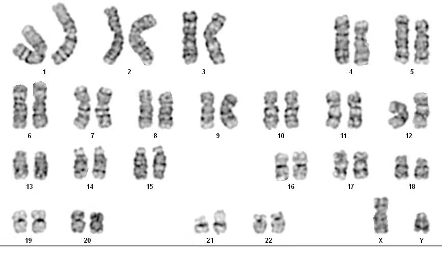 染色体核型命名规则（二）：符号和简写术语
